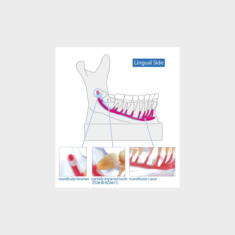 Mandibular Nervemodel